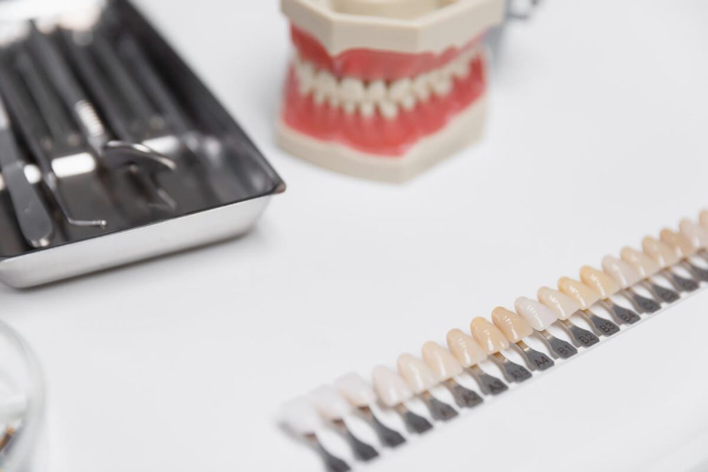 the process of getting porcelain veneers