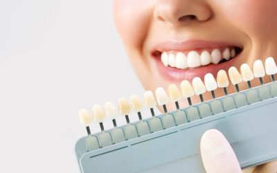 Porcelain Veneers: Procedure, Benefits, Costs, and Smile Transformation Guide
