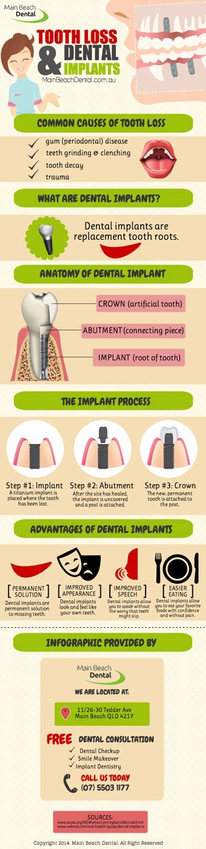 Tooth Loss And Dental Implants