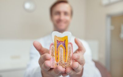 What You Should Know About Root Canal Treatment