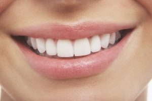 Teeth Whitening Addiction