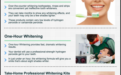 The Best and Worst Tooth Whitening Options