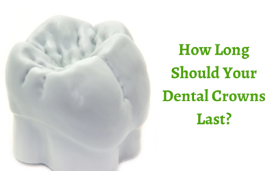 How Long Should Your Dental Crowns Last?