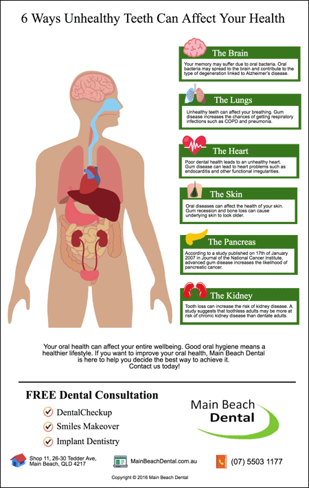 Gold Coast Dentist Trivia: 6 Ways Unhealthy Teeth Can Affect Your Health