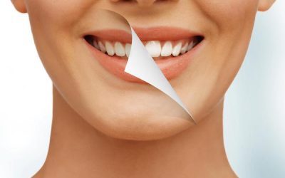 Why Your Teeth Won’t Get Whiter