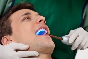 Tooth Bonding Economical And Quick Tooth Repair main beach dentist