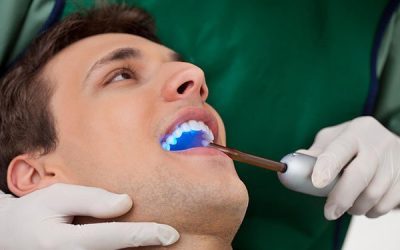 Tooth Bonding – Economical And Quick Tooth Repair