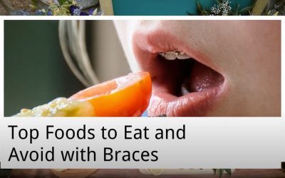 Top Foods to Eat and Avoid with Braces from Main Beach Dental