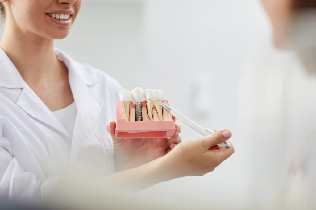 top 6 reasons dental implants are the leading choice for replacing missing teeth